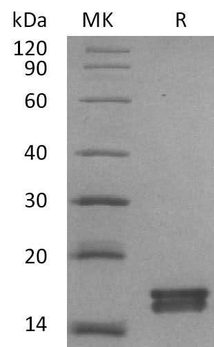 Recombinant Mouse AGR3 Protein (His Tag) - ABMIUM