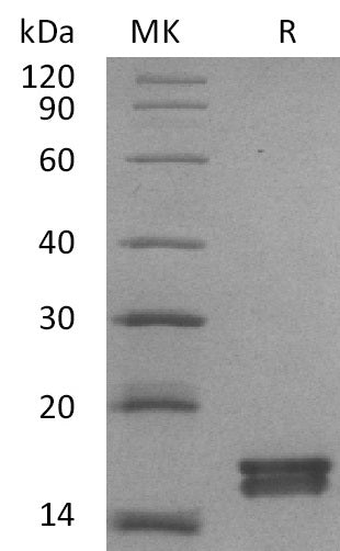 Recombinant Mouse AGR3 Protein (His Tag) - ABMIUM