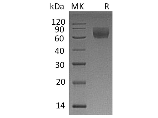 Recombinant Rhesus macaque CD47/IAP Protein (Fc Tag) - ABMIUM