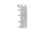 SDS-PAGE analysis of Mouse Adiponectin proteins, 2 μg/lane of Recombinant Mouse Adiponectin proteins was resolved with SDS-PAGE under reducing conditions, showing bands at 42 kDa.