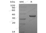 Recombinant Mouse LDHA/LDH1 Protein (His Tag) - ABMIUM