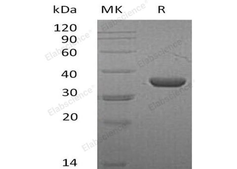 Recombinant Mouse LDHA/LDH1 Protein (His Tag) - ABMIUM