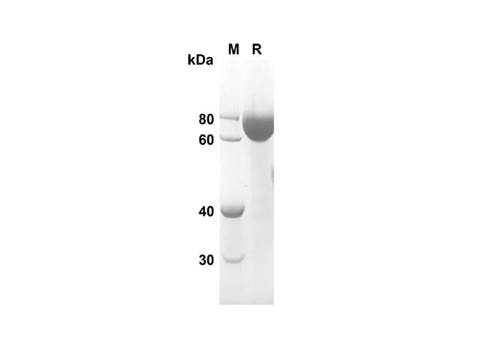 SDS-PAGE analysis of Rat CD14 proteins, 2 μg/lane of Recombinant Rat CD14 proteins was resolved with an SDS-PAGE under reducing conditions, showing bands at 60.5 kDa.