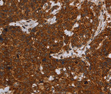 Anti-Human ERRFI1 Antibody - ABMIUM