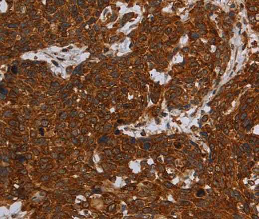 Anti-Human ERRFI1 Antibody