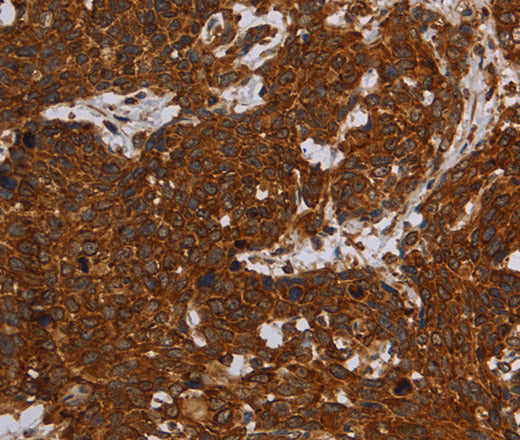 Anti-Human ERRFI1 Antibody - ABMIUM