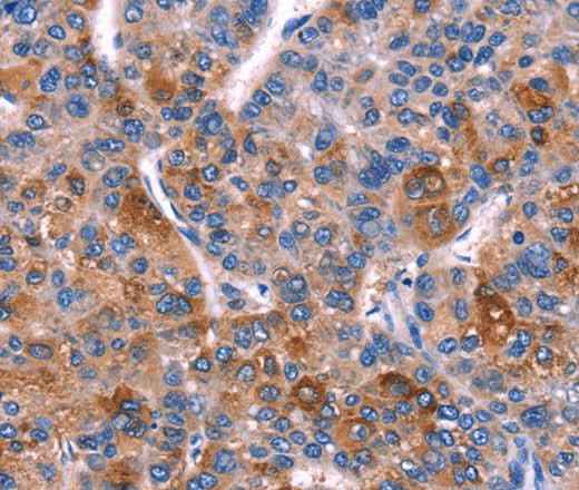 Anti-Human/Mouse DUSP13 Antibody