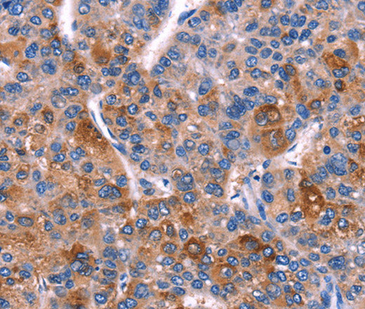 Anti-Human/Mouse DUSP13 Antibody - ABMIUM