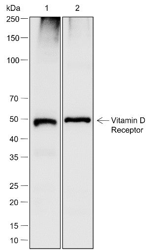 Anti-Human/Mouse Vitamin D Receptor Antibody [A789] - ABMIUM