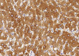 Anti-Human CHRD Antibody [B217]