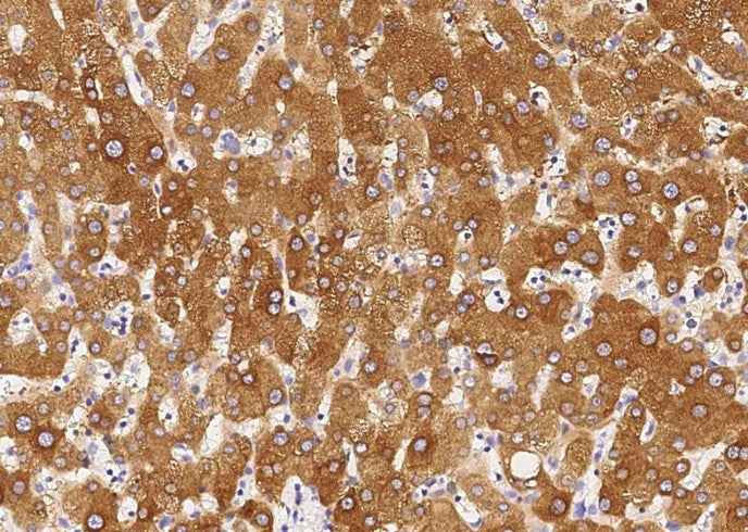 Anti-Human CHRD Antibody [B217] - ABMIUM