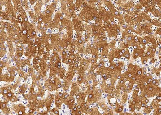 Anti-Human CHRD Antibody [B217] - ABMIUM