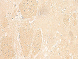 Immunohistochemistry of paraffin-embedded Human brain tissue using IL37 Polyclonal Antibody at dilution of 1:50(×200)