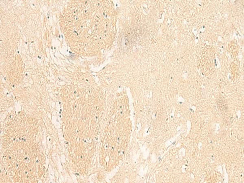 Immunohistochemistry of paraffin-embedded Human brain tissue using IL37 Polyclonal Antibody at dilution of 1:50(×200)