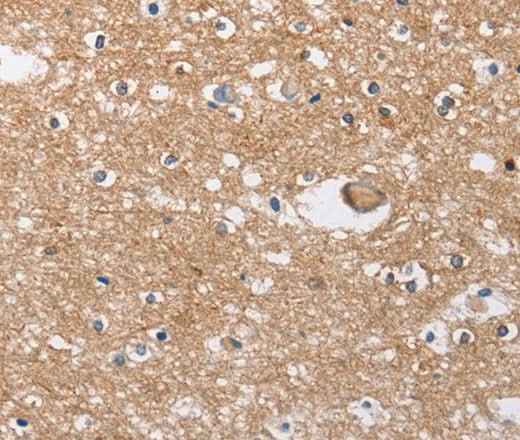 Anti-Human/Mouse/Rat SOCS2 Antibody