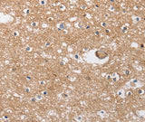 Anti-Human/Mouse/Rat SOCS2 Antibody - ABMIUM