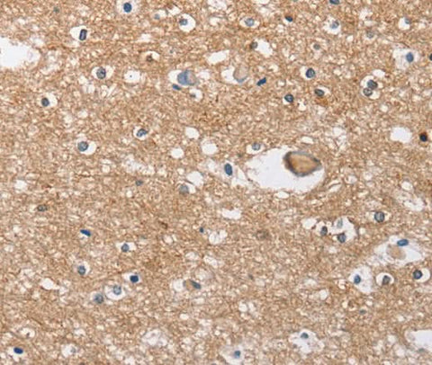 Anti-Human/Mouse/Rat SOCS2 Antibody - ABMIUM