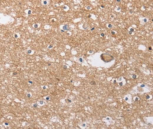 Anti-Human/Mouse/Rat SOCS2 Antibody - ABMIUM