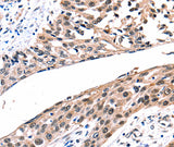 Anti-Human/Rat GJB2 Antibody - ABMIUM