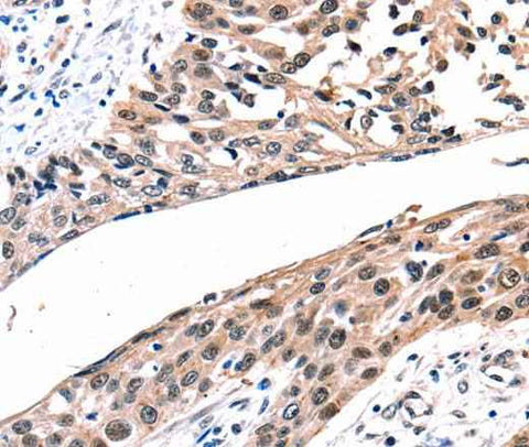 Anti-Human/Rat GJB2 Antibody