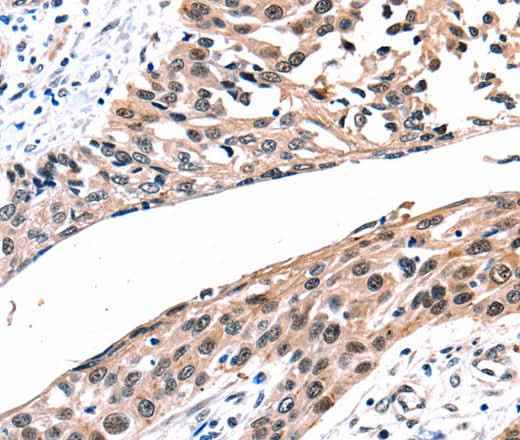 Anti-Human/Rat GJB2 Antibody