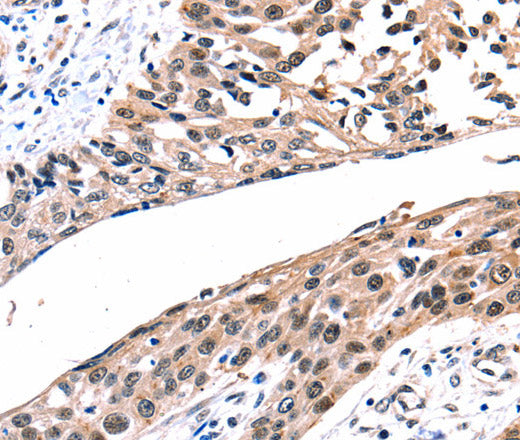 Anti-Human/Rat GJB2 Antibody - ABMIUM