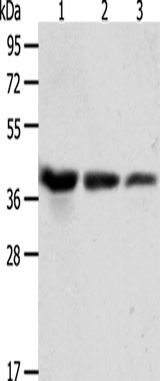 Anti-Human/Mouse/Rat ANXA1 Antibody - ABMIUM
