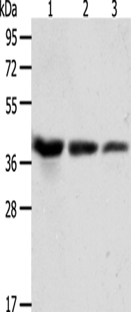 Anti-Human/Mouse/Rat ANXA1 Antibody - ABMIUM