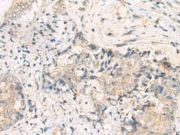 Anti-Human/Mouse MGAT4B Antibody