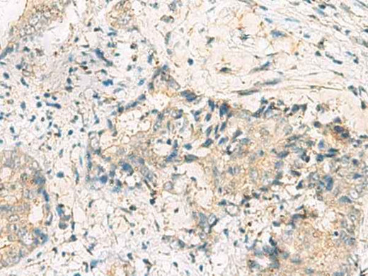 Anti-Human/Mouse MGAT4B Antibody