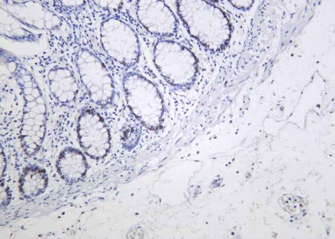 Anti-Human/Mouse/Rat MCM2 Antibody [B1037]