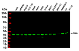 Anti-Human/Mouse/Rat α smooth muscle actin Antibody [B763]
