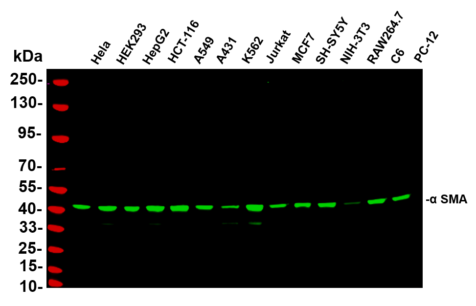 Anti-Human/Mouse/Rat α smooth muscle actin Antibody [B763] - ABMIUM