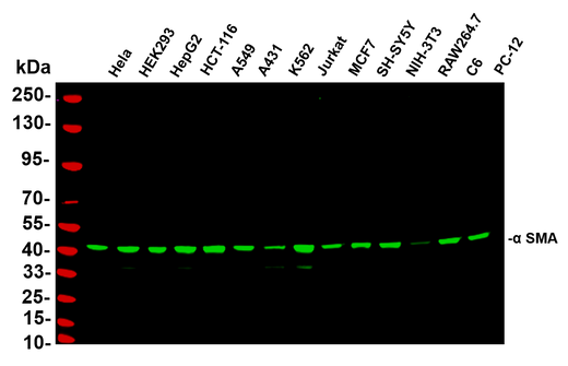 Anti-Human/Mouse/Rat α smooth muscle actin Antibody [B763] - ABMIUM
