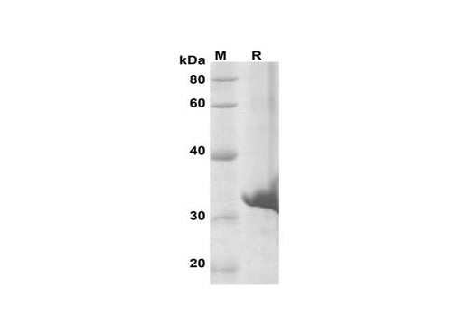 SDS-PAGE analysis of Human MCM8 proteins, 2 μg/lane of Recombinant Human MCM8 proteins was resolved with SDS-PAGE under reducing conditions, showing bands at 32 kDa.