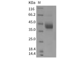 Recombinant Mouse ART4/CD297 Protein (His Tag) - ABMIUM