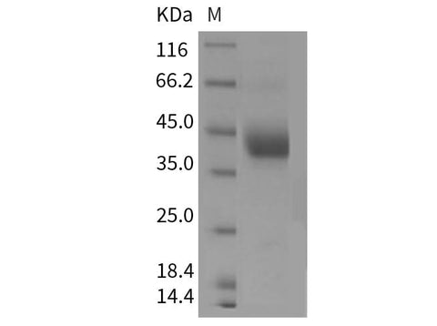 Recombinant Mouse ART4/CD297 Protein (His Tag) - ABMIUM