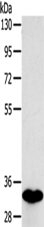 Anti-Human SULT1B1 Antibody - ABMIUM