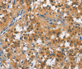 Anti-Human/Rat CUL7 Antibody - ABMIUM