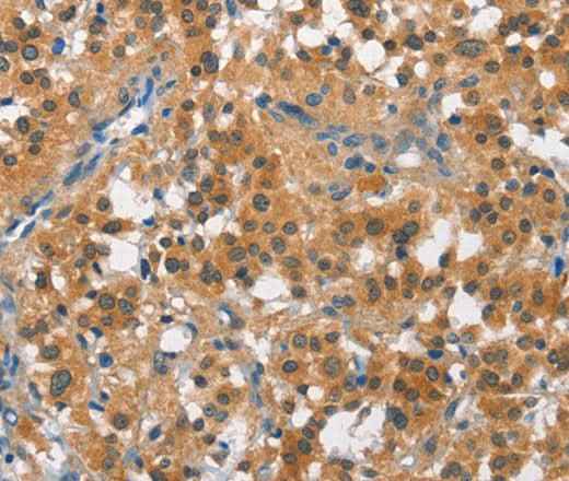 Anti-Human/Rat CUL7 Antibody
