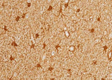 Anti-Human PRDX6 Antibody [A892] - ABMIUM