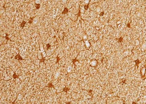 Anti-Human PRDX6 Antibody [A892] - ABMIUM