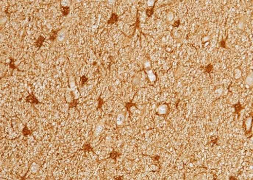 Anti-Human PRDX6 Antibody [A892] - ABMIUM