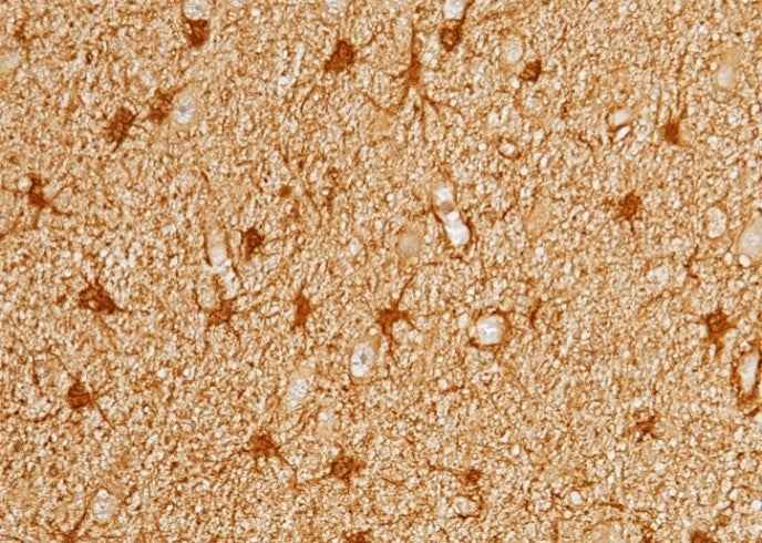 Anti-Human PRDX6 Antibody [A892] - ABMIUM