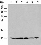Western blot analysis of 293T and PC3 cell Mouse spleen tissue 231 cell Human breast cancer tissue Mouse kidney tissue lysates using RPS28 Polyclonal Antibody at dilution of 1:200