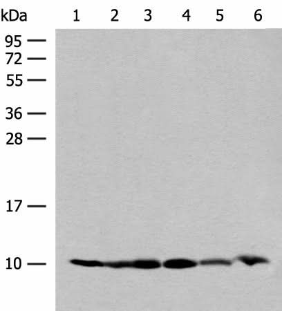 Western blot analysis of 293T and PC3 cell Mouse spleen tissue 231 cell Human breast cancer tissue Mouse kidney tissue lysates using RPS28 Polyclonal Antibody at dilution of 1:200