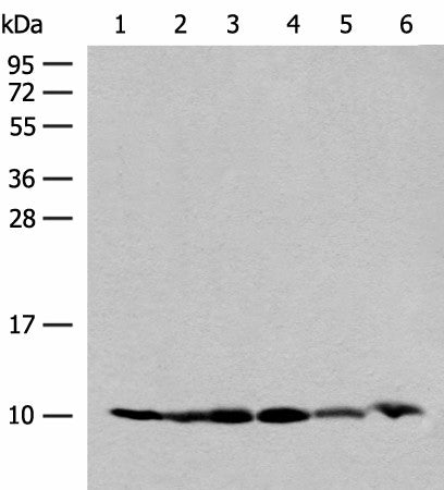 Western blot analysis of 293T and PC3 cell Mouse spleen tissue 231 cell Human breast cancer tissue Mouse kidney tissue lysates using RPS28 Polyclonal Antibody at dilution of 1:200