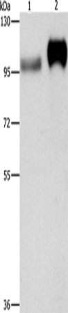 Anti-Human/Mouse CD61 Antibody - ABMIUM