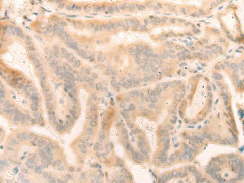 Anti-Human ELP4 Antibody - ABMIUM