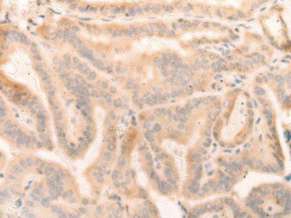 Anti-Human ELP4 Antibody - ABMIUM